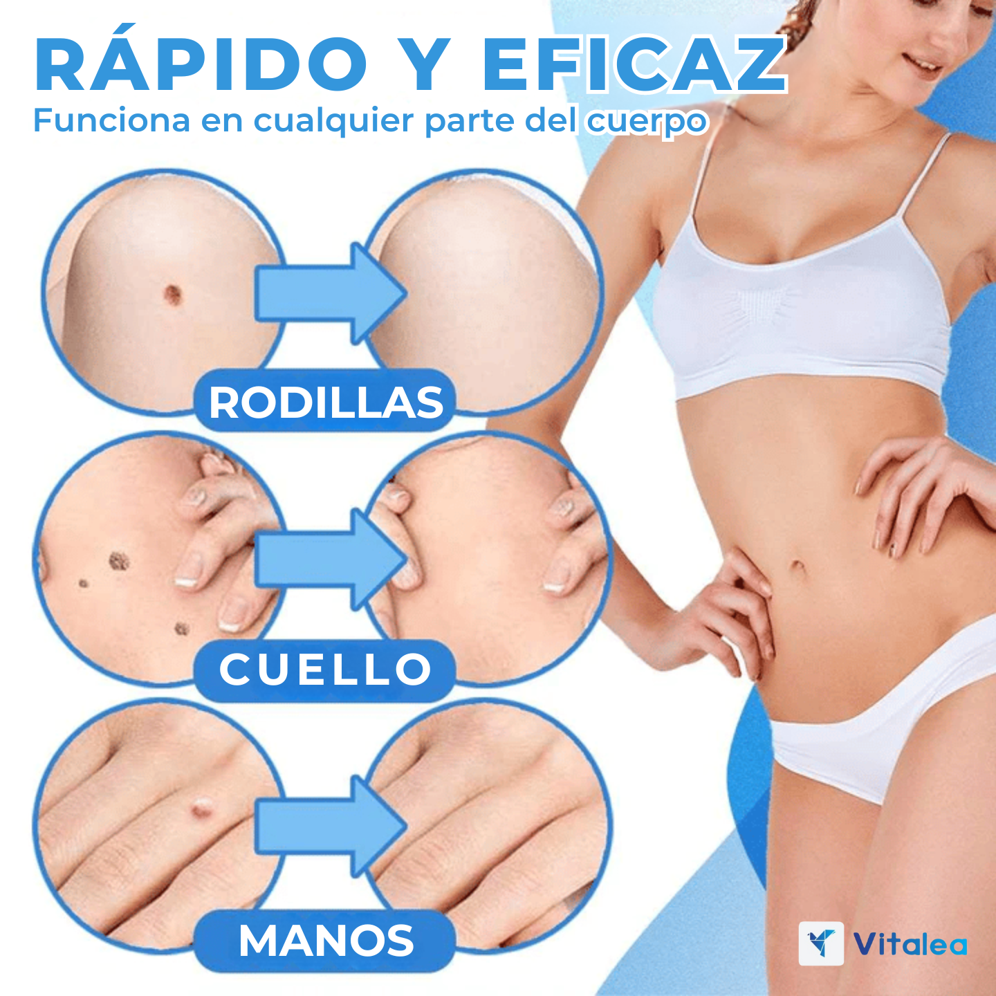 1+1 GRATIS| Vitalea PerfectFace™- Kit de eliminación de verrugas natural